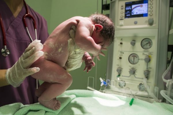 Császármetszés kontra hüvelyi szülés: tényekről